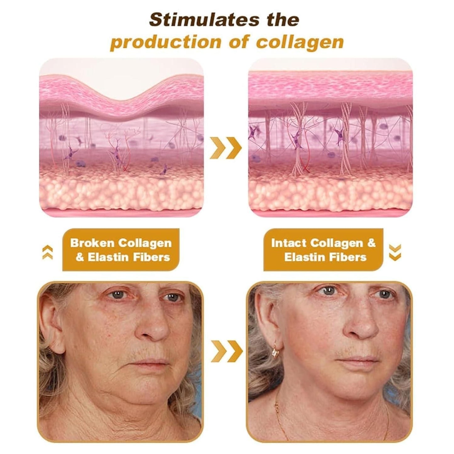 BoTox™ - Bee Venom Wrinkle Repair Cream - 20g🐝✨(Buy 1 Get 1 Free 🔥🔥)