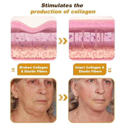 BoTox™ - Bee Venom Wrinkle Repair Cream - 20g🐝✨(Buy 1 Get 1 Free 🔥🔥)
